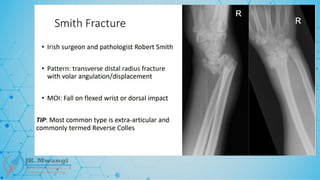 Fracture Classification .pptx notes for orth