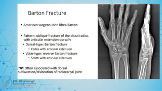 Fracture Classification .pptx notes for orth