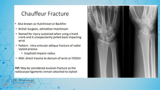 Fracture Classification .pptx notes for orth