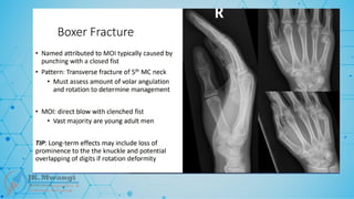 Fracture Classification .pptx notes for orth