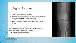 Fracture Classification .pptx notes for orth