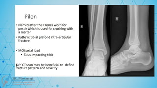 Fracture Classification .pptx notes for orth