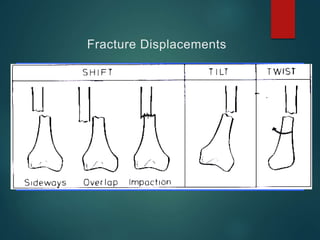 Fracture Displacements
 