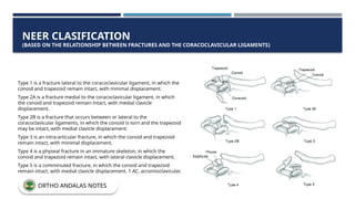 Type 1 is a fracture lateral to the coracoclavicular ligament, in which the
conoid and trapezoid remain intact, with minimal displacement.
Type 2A is a fracture medial to the coracoclavicular ligament, in which
the conoid and trapezoid remain intact, with medial clavicle
displacement.
Type 2B is a fracture that occurs between or lateral to the
coracoclavicular ligaments, in which the conoid is torn and the trapezoid
may be intact, with medial clavicle displacement.
Type 3 is an intra-articular fracture, in which the conoid and trapezoid
remain intact, with minimal displacement.
Type 4 is a physeal fracture in an immature skeleton, in which the
conoid and trapezoid remain intact, with lateral clavicle displacement.
Type 5 is a comminuted fracture, in which the conoid and trapezoid
remain intact, with medial clavicle displacement. 1 AC, acromioclavicular.
NEER CLASIFICATION
(BASED ON THE RELATIONSHIP BETWEEN FRACTURES AND THE CORACOCLAVICULAR LIGAMENTS)
ORTHO ANDALAS NOTES
 