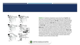ORTHO ANDALAS NOTES
 
