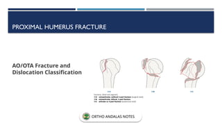 PROXIMAL HUMERUS FRACTURE
AO/OTA Fracture and
Dislocation Classification
ORTHO ANDALAS NOTES
 
