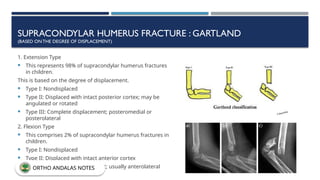 SUPRACONDYLAR HUMERUS FRACTURE : GARTLAND
(BASED ONTHE DEGREE OF DISPLACEMENT)
1. Extension Type
 This represents 98% of supracondylar humerus fractures
in children.
This is based on the degree of displacement.
 Type I: Nondisplaced
 Type II: Displaced with intact posterior cortex; may be
angulated or rotated
 Type III: Complete displacement; posteromedial or
posterolateral
2. Flexion Type
 This comprises 2% of supracondylar humerus fractures in
children.
 Type I: Nondisplaced
 Type II: Displaced with intact anterior cortex
 Type III: Complete displacement; usually anterolateral
ORTHO ANDALAS NOTES
 