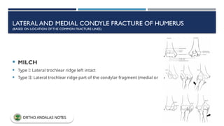 LATERAL AND MEDIAL CONDYLE FRACTURE OF HUMERUS
(BASED ON LOCATION OF THE COMMON FRACTURE LINES)
 MILCH
 Type I: Lateral trochlear ridge left intact
 Type II: Lateral trochlear ridge part of the condylar fragment (medial or lateral)
ORTHO ANDALAS NOTES
 