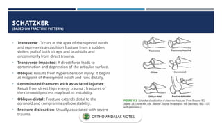 SCHATZKER
(BASED ON FRACTURE PATTERN)
• Transverse: Occurs at the apex of the sigmoid notch
and represents an avulsion fracture from a sudden,
violent pull of both triceps and brachialis and
uncommonly from direct trauma.
• Transverse-impacted: A direct force leads to
comminution and depression of the articular surface.
• Oblique: Results from hyperextension injury; it begins
at midpoint of the sigmoid notch and runs distally.
• Comminuted fractures with associated injuries:
Result from direct high energy trauma ; fractures of
the coronoid process may lead to instability.
• Oblique-distal : Fracture extends distal to the
coronoid and compromises elbow stability.
• Fracture-dislocation: Usually associated with severe
trauma.
ORTHO ANDALAS NOTES
 