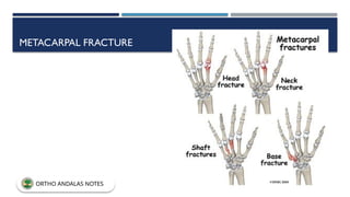 METACARPAL FRACTURE
ORTHO ANDALAS NOTES
 