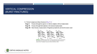 VERTICAL COMPRESSION
(BURST FRACTURES)
ORTHO ANDALAS NOTES
 