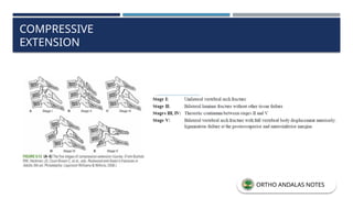 COMPRESSIVE
EXTENSION
ORTHO ANDALAS NOTES
 