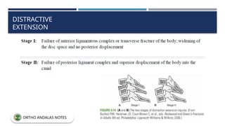 DISTRACTIVE
EXTENSION
ORTHO ANDALAS NOTES
 