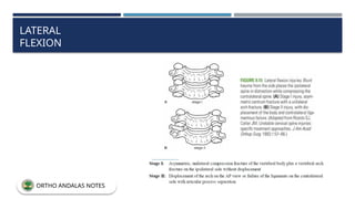 LATERAL
FLEXION
ORTHO ANDALAS NOTES
 