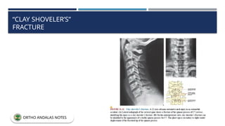 “CLAY SHOVELER’S”
FRACTURE
ORTHO ANDALAS NOTES
 