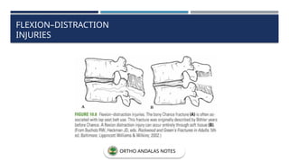 FLEXION–DISTRACTION
INJURIES
ORTHO ANDALAS NOTES
 