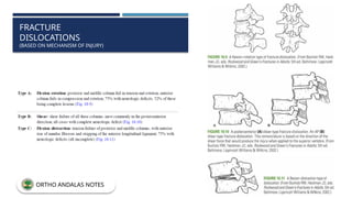 FRACTURE
DISLOCATIONS
(BASED ON MECHANISM OF INJURY)
ORTHO ANDALAS NOTES
 