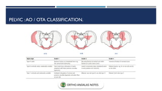 PELVIC :AO / OTA CLASSIFICATION.
ORTHO ANDALAS NOTES
 