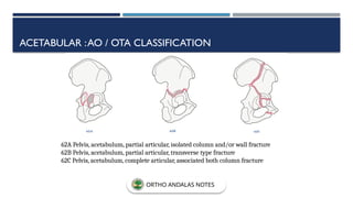 ACETABULAR :AO / OTA CLASSIFICATION
62A Pelvis, acetabulum, partial articular, isolated column and/or wall fracture
62B Pelvis, acetabulum, partial articular, transverse type fracture
62C Pelvis, acetabulum, complete articular, associated both column fracture
ORTHO ANDALAS NOTES
 