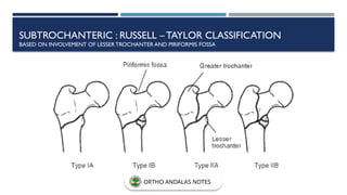 SUBTROCHANTERIC : RUSSELL –TAYLOR CLASSIFICATION
BASED ON INVOLVEMENT OF LESSERTROCHANTER AND PIRIFORMIS FOSSA
ORTHO ANDALAS NOTES
 