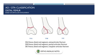 AO / OTA CLASSIFICATION
DISTAL FEMUR
BASED ON ARTICULAR INVOLVEMENT
33A Femur, distal end segment, extraarticular fracture
33B Femur, distal end segment, partial articular fracture
33C Femur, distal end segment, complete articular fracture
ORTHO ANDALAS NOTES
 