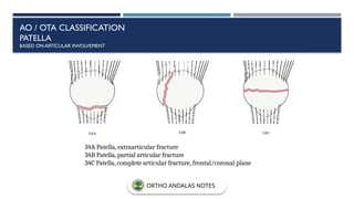 AO / OTA CLASSIFICATION
PATELLA
BASED ON ARTICULAR INVOLVEMENT
34A Patella, extraarticular fracture
34B Patella, partial articular fracture
34C Patella, complete articular fracture, frontal/coronal plane
ORTHO ANDALAS NOTES
 