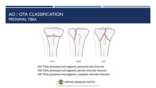 AO / OTA CLASSIFICATION
PROXIMAL TIBIA
41A Tibia, proximal end segment, extraarticular fracture
41B Tibia, proximal end segment, partial articular fracture
43C Tibia, proximal end segment, complete articular fracture
ORTHO ANDALAS NOTES
 