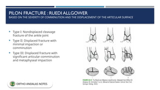 PILON FRACTURE : RUEDI ALLGOWER
BASED ON THE SEVERITY OF COMMINUTION AND THE DISPLACEMENT OF THE ARTICULAR SURFACE
 Type I: Nondisplaced cleavage
fracture of the ankle joint
 Type II: Displaced fracture with
minimal impaction or
comminution
 Type III: Displaced fracture with
significant articular comminution
and metaphyseal impaction
ORTHO ANDALAS NOTES
 