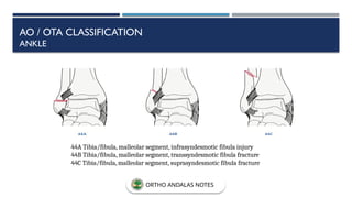 44A Tibia/fibula, malleolar segment, infrasyndesmotic fibula injury
44B Tibia/fibula, malleolar segment, transsyndesmotic fibula fracture
44C Tibia/fibula, malleolar segment, suprasyndesmotic fibula fracture
AO / OTA CLASSIFICATION
ANKLE
ORTHO ANDALAS NOTES
 