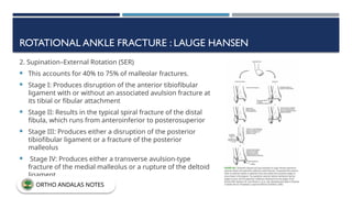 ROTATIONAL ANKLE FRACTURE : LAUGE HANSEN
2. Supination–External Rotation (SER)
 This accounts for 40% to 75% of malleolar fractures.
 Stage I: Produces disruption of the anterior tibiofibular
ligament with or without an associated avulsion fracture at
its tibial or fibular attachment
 Stage II: Results in the typical spiral fracture of the distal
fibula, which runs from anteroinferior to posterosuperior
 Stage III: Produces either a disruption of the posterior
tibiofibular ligament or a fracture of the posterior
malleolus
 Stage IV: Produces either a transverse avulsion-type
fracture of the medial malleolus or a rupture of the deltoid
ligament
ORTHO ANDALAS NOTES
 
