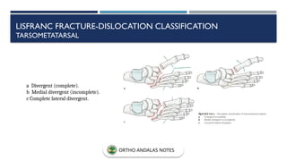 a Divergent (complete).
b Medial divergent (incomplete).
c Complete lateral divergent.
LISFRANC FRACTURE-DISLOCATION CLASSIFICATION
TARSOMETATARSAL
ORTHO ANDALAS NOTES
 