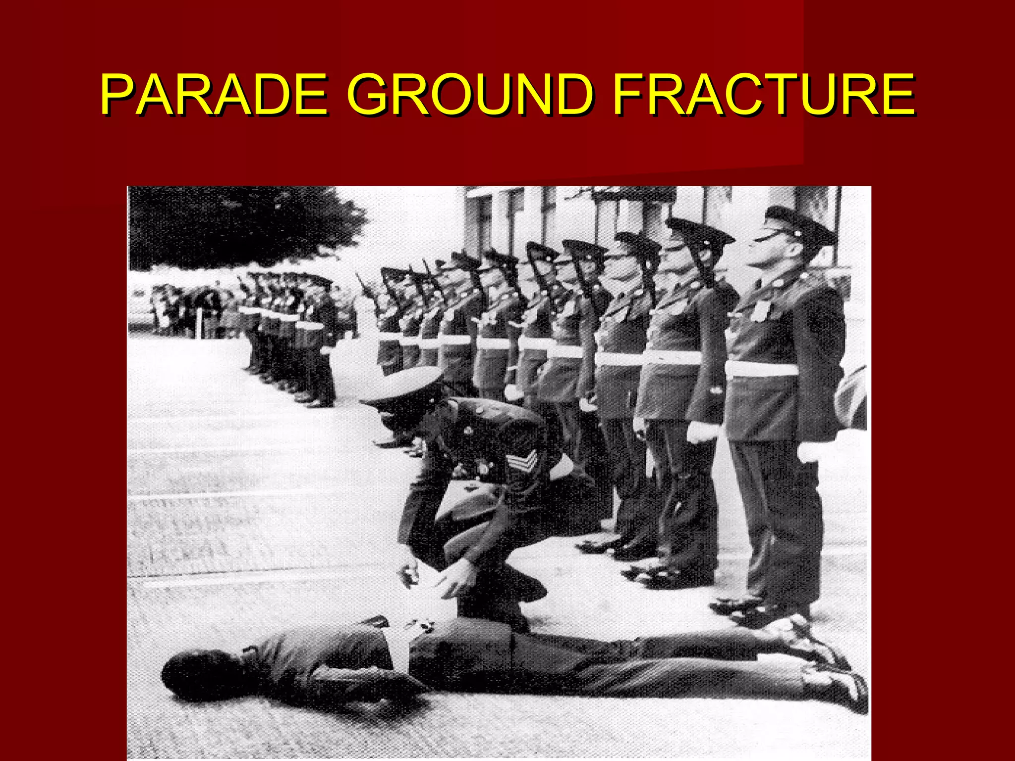 PPAARRAADDEE GGRROOUUNNDD FFRRAACCTTUURREE 
 