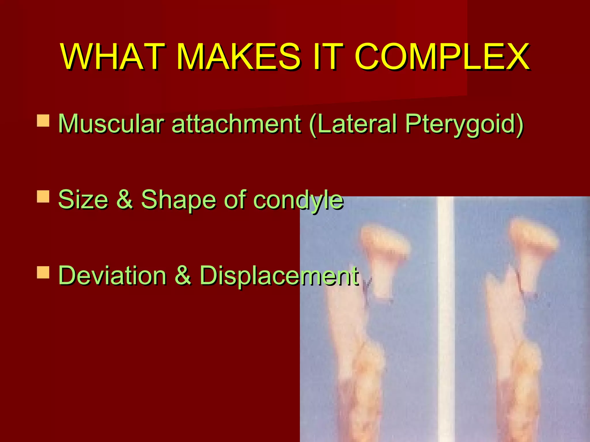 WWHHAATT MMAAKKEESS IITT CCOOMMPPLLEEXX 
 MMuussccuullaarr aattttaacchhmmeenntt ((LLaatteerraall PPtteerryyggooiidd)) 
 SSiizzee && SShhaappee ooff ccoonnddyyllee 
 DDeevviiaattiioonn && DDiissppllaacceemmeenntt 
 