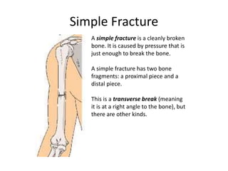 Fractured bones | PPTX