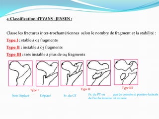 Fracture de massif pert.pdf