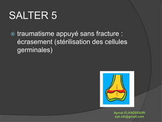 SALTER 5 
 traumatisme appuyé sans fracture : 
écrasement (stérilisation des cellules 
germinales) 
Ayoub ELKADDOURI 
ayb.elk@gmail.com 
 