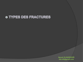 Ayoub ELKADDOURI 
ayb.elk@gmail.com 
 