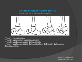 La classification de Hawkins pour les 
fractures de la tête de l’astragale 
Type 1: = non déplacé 
Type 2: subluxation subastragalienne 
Type 3: luxation du corps de l’astragale 
Type 4: luxation du corps de l’astragale et distraction du ligament 
talonaviculaire. 
Ayoub ELKADDOURI 
ayb.elk@gmail.com 
 