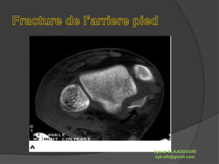 Ayoub ELKADDOURI 
ayb.elk@gmail.com 
 