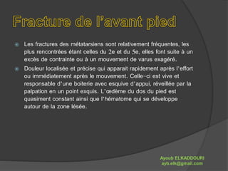  Les fractures des métatarsiens sont relativement fréquentes, les 
plus rencontrées étant celles du 2e et du 5e, elles font suite à un 
excès de contrainte ou à un mouvement de varus exagéré. 
 Douleur localisée et précise qui apparait rapidement après l’effort 
ou immédiatement après le mouvement. Celle-ci est vive et 
responsable d’une boiterie avec esquive d’appui, réveillée par la 
palpation en un point exquis. L’oedème du dos du pied est 
quasiment constant ainsi que l’hématome qui se développe 
autour de la zone lésée. 
Ayoub ELKADDOURI 
ayb.elk@gmail.com 
 