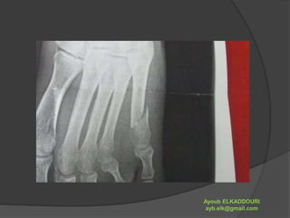 Ayoub ELKADDOURI 
ayb.elk@gmail.com 
 