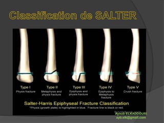 Ayoub ELKADDOURI 
ayb.elk@gmail.com 
 