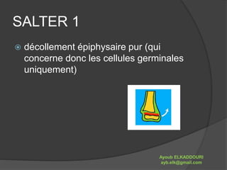 SALTER 1 
 décollement épiphysaire pur (qui 
concerne donc les cellules germinales 
uniquement) 
Ayoub ELKADDOURI 
ayb.elk@gmail.com 
 