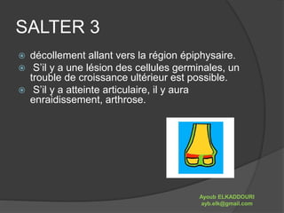 SALTER 3 
 décollement allant vers la région épiphysaire. 
 S’il y a une lésion des cellules germinales, un 
trouble de croissance ultérieur est possible. 
 S’il y a atteinte articulaire, il y aura 
enraidissement, arthrose. 
Ayoub ELKADDOURI 
ayb.elk@gmail.com 
 