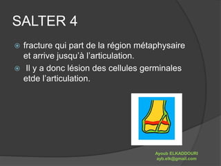 SALTER 4 
 fracture qui part de la région métaphysaire 
et arrive jusqu’à l’articulation. 
 Il y a donc lésion des cellules germinales 
etde l’articulation. 
Ayoub ELKADDOURI 
ayb.elk@gmail.com 
 