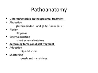 Pathoanatomy
• Deforming forces on the proximal fragment
• Abduction
gluteus medius and gluteus minimus
• Flexion
iliopsoas
• External rotation
short external rotators
• deforming forces on distal fragment
• Adduction
hip adductors
• Shortening
quads and hamstrings
 