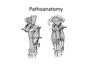 Pathoanatomy
 