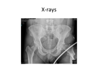 X-rays
 