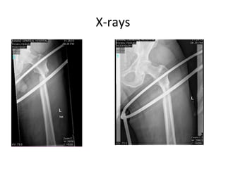 X-rays
 
