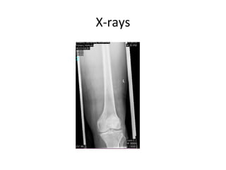 X-rays
 